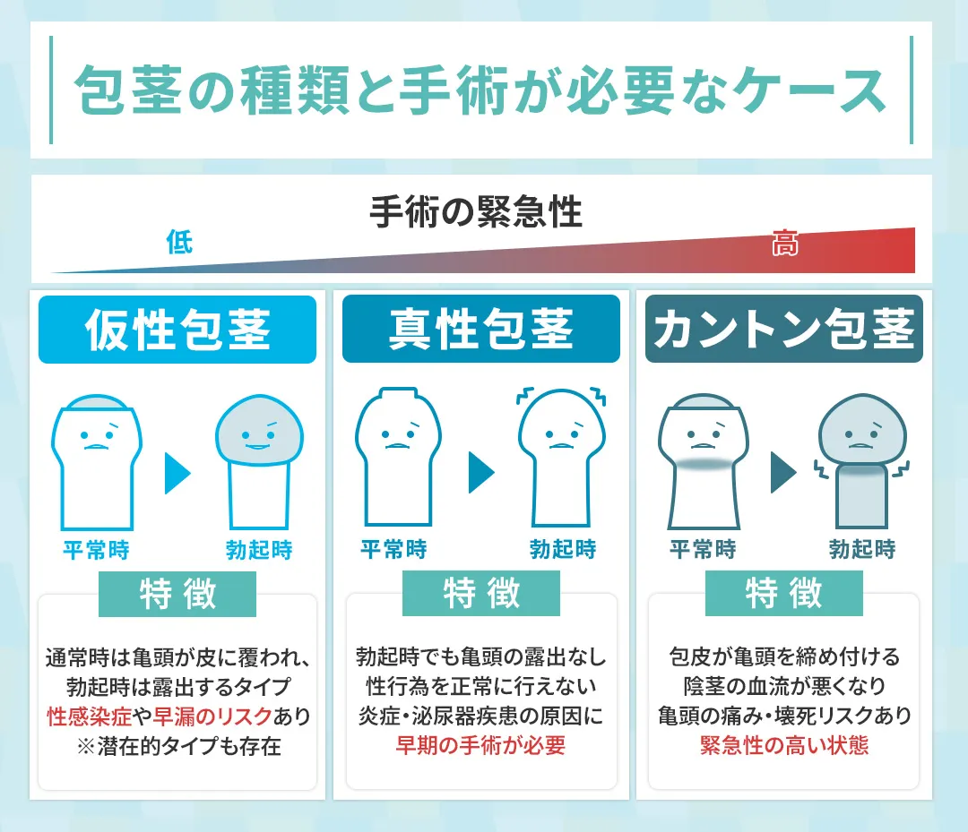 包茎の種類と包茎手術が必要になるケース
