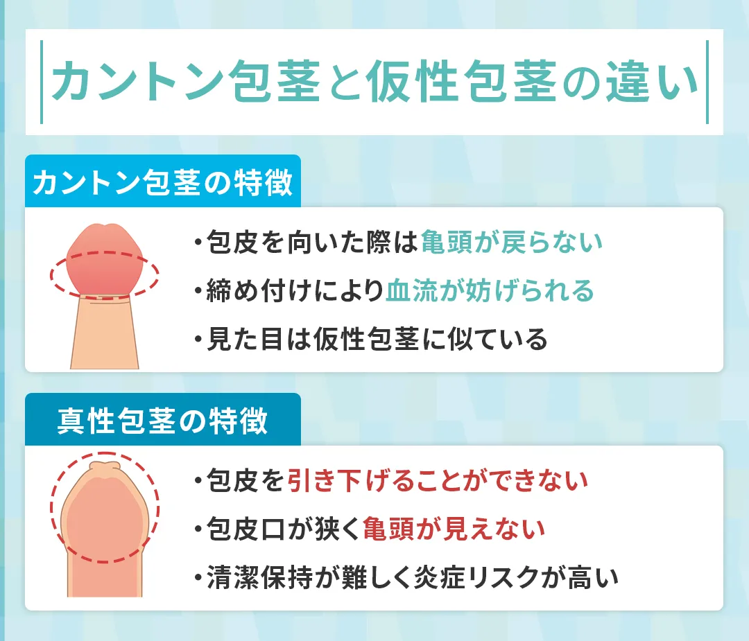 カントン包茎と真性・仮性包茎の違い