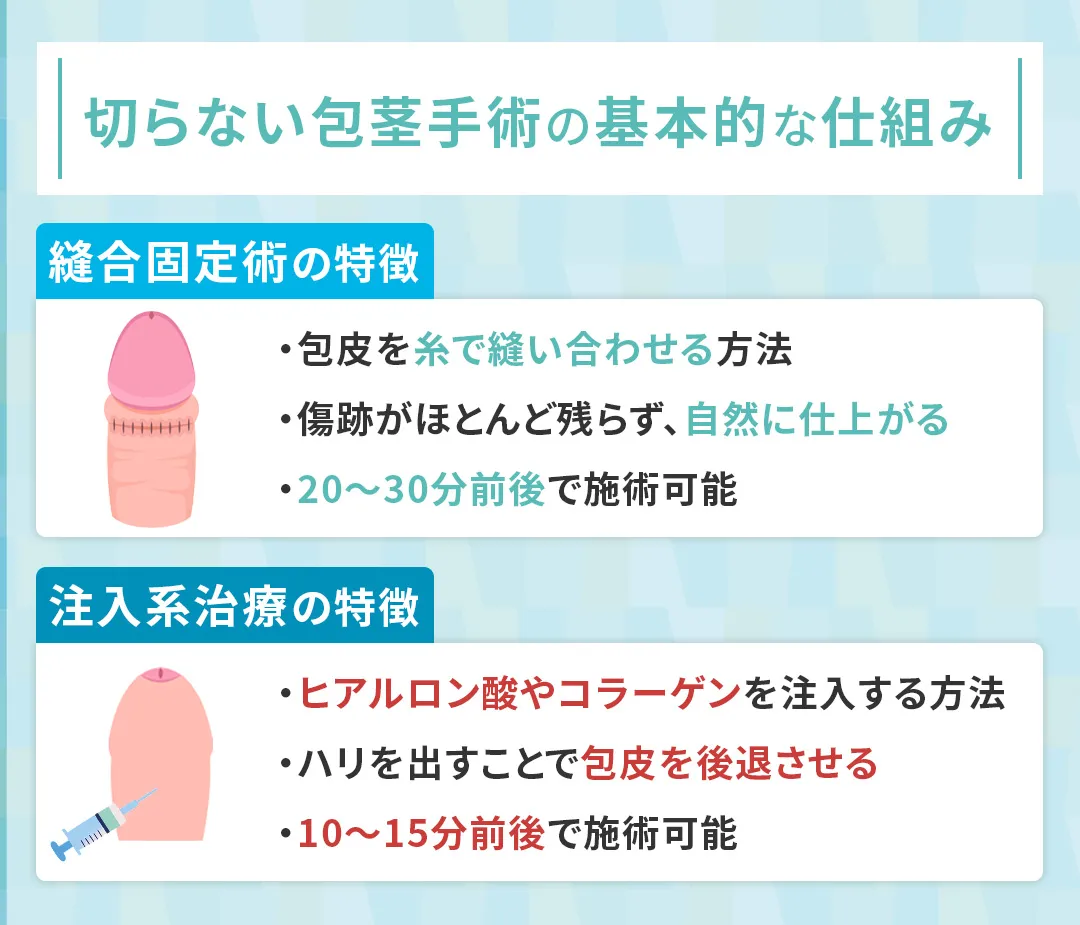 切らない包茎手術の仕組み