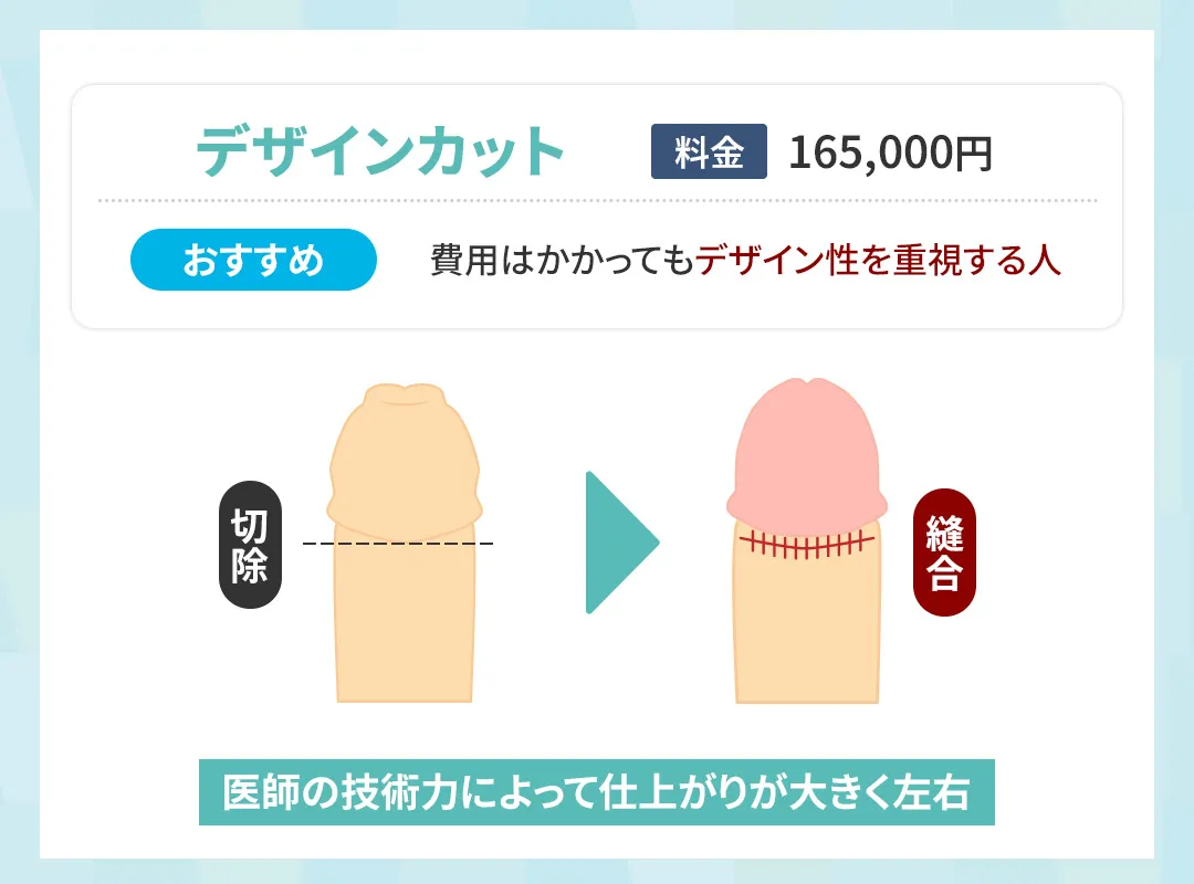 メンズライフクリニックのデザインカット