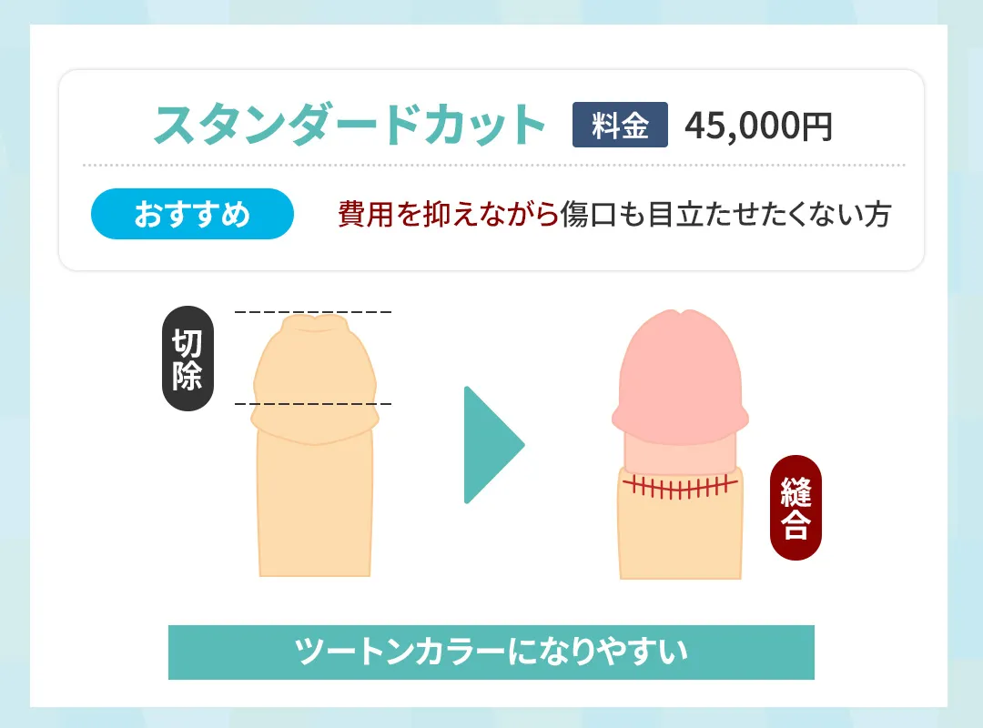 メンズライフクリニックのスタンダードカット