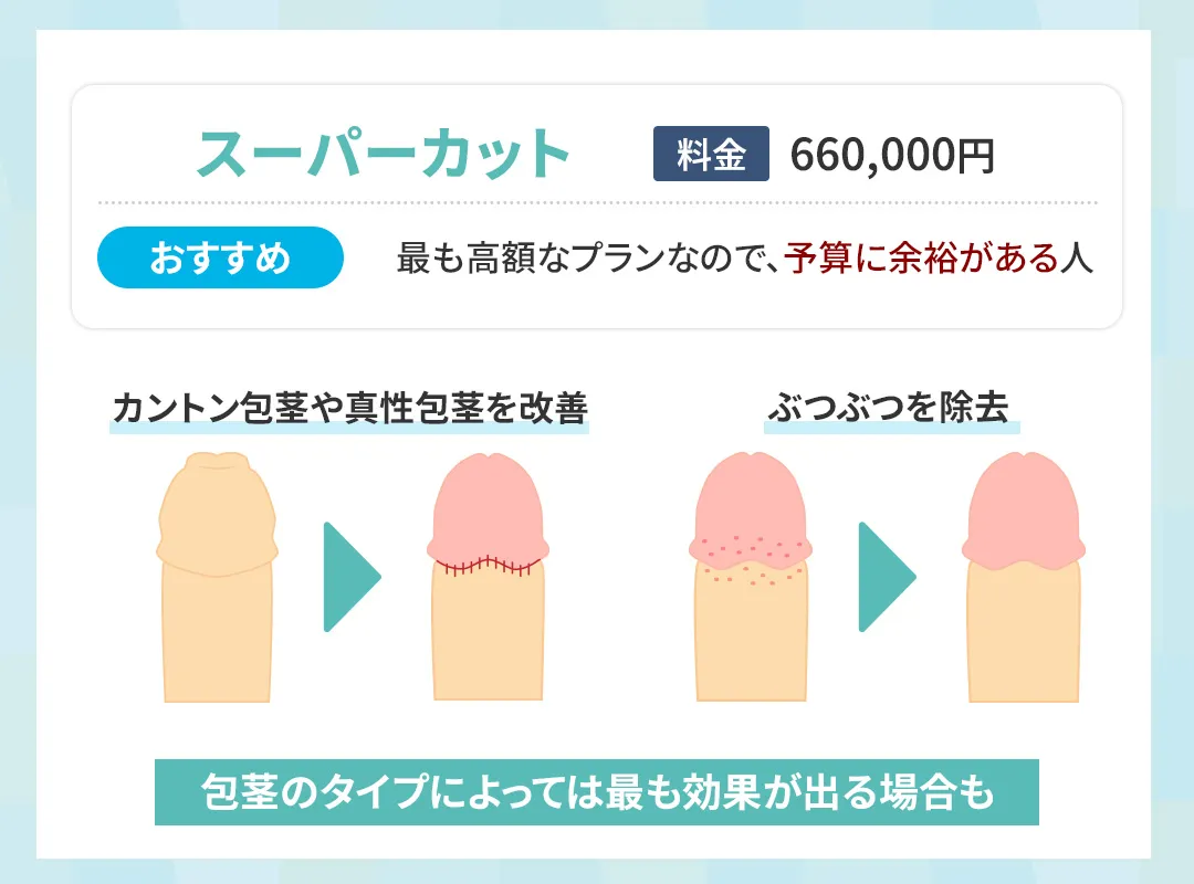 メンズライフクリニックのスーパーカット