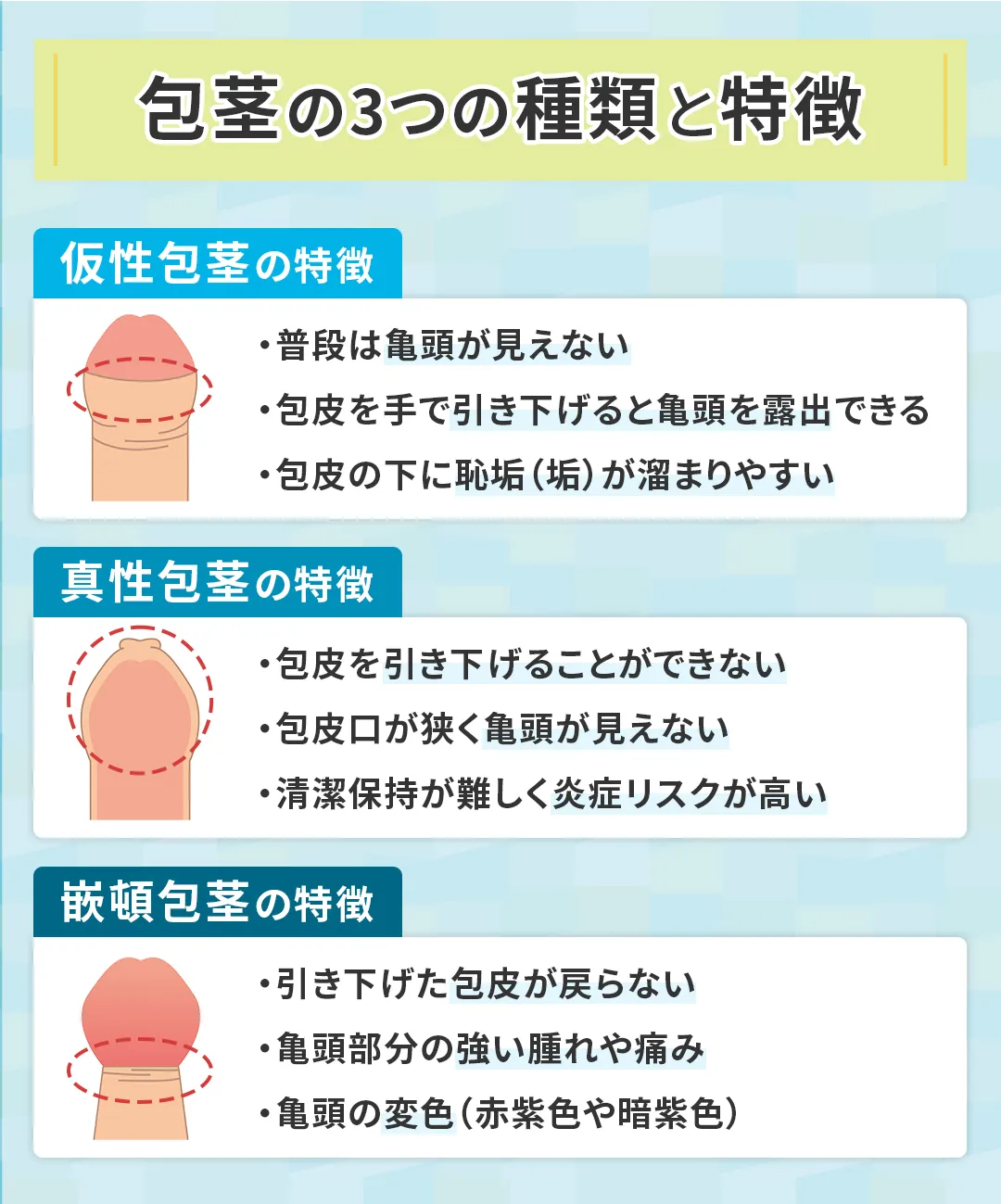包茎の3つの種類