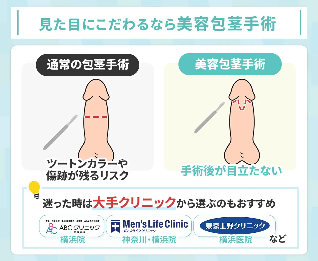 横浜で包茎手術を受けるなら仕上がりが自然な美容包茎手術がおすすめ