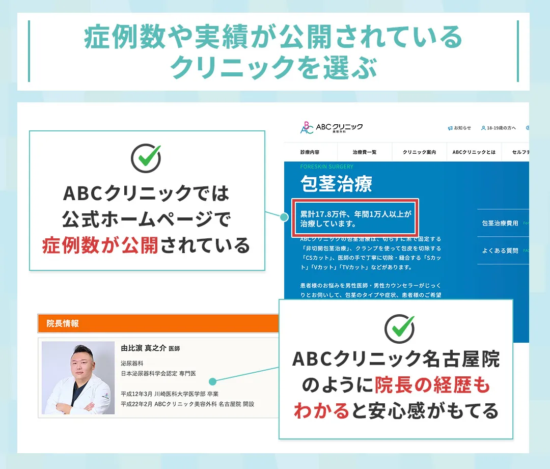ABCクリニックではホームページに症例数や院長の実績が明記されており安心材料の一つになる